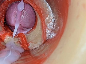 Female Insemination - Internal Camera Captures Deep Male Huge Ejaculation gay asian man sexual relations videos