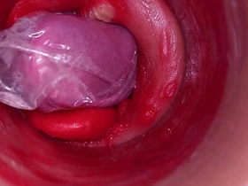 The camera inside the deep pussy records a huge ejaculation with a stuck condom gay sex videos latest asian