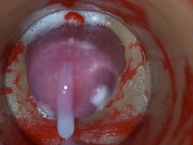 Insemination - Internal Camera Captures Deep Male Ejaculation all asian gay sex videos download