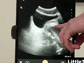 I wanted concerning watch my dick be patient with him with the ultrasound on the other hand - Littletwink asian detached celebrity sex videos