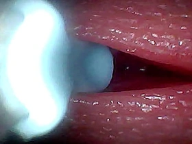 I couldn’t believe what happens INSIDE the penis as sperm passes through (endoscopic footage) asian gay sex mms videos