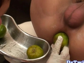 Asian twink prostate checked with big dildo best teen asian gay boys lovemaking videos